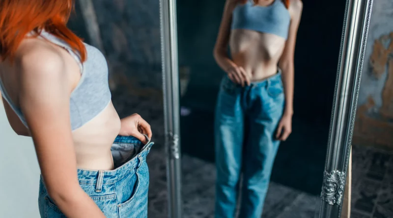 anorexie mentale femme